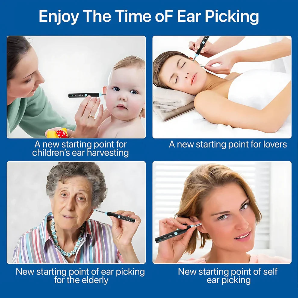 Mart and More Smart Ear Wax Cleaner with 1296P HD Camera & LED Light