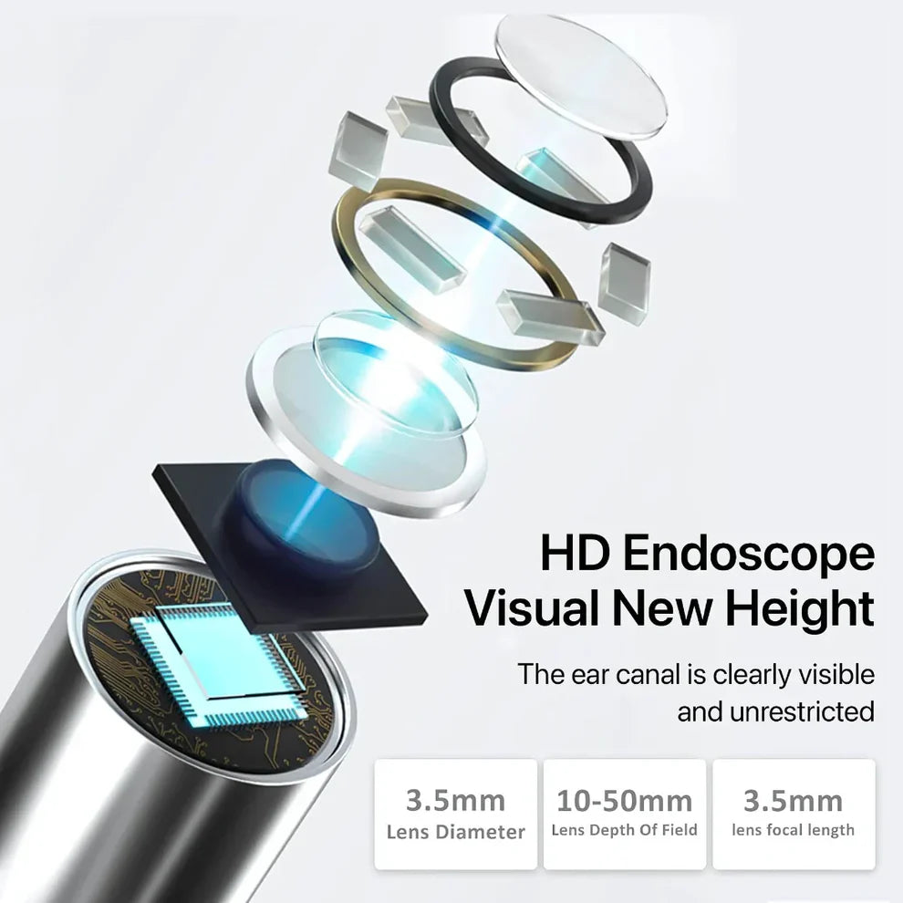 Mart and More Smart Ear Wax Cleaner with 1296P HD Camera & LED Light