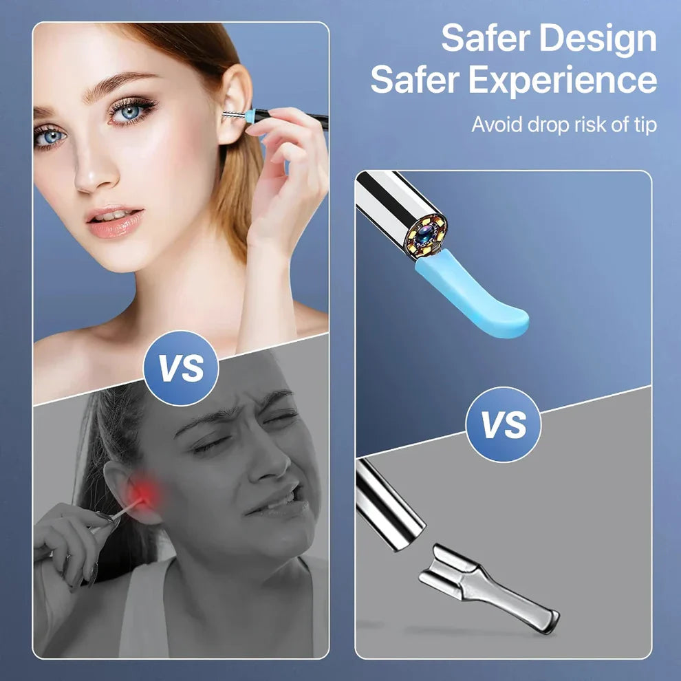 Mart and More Smart Ear Wax Cleaner with 1296P HD Camera & LED Light
