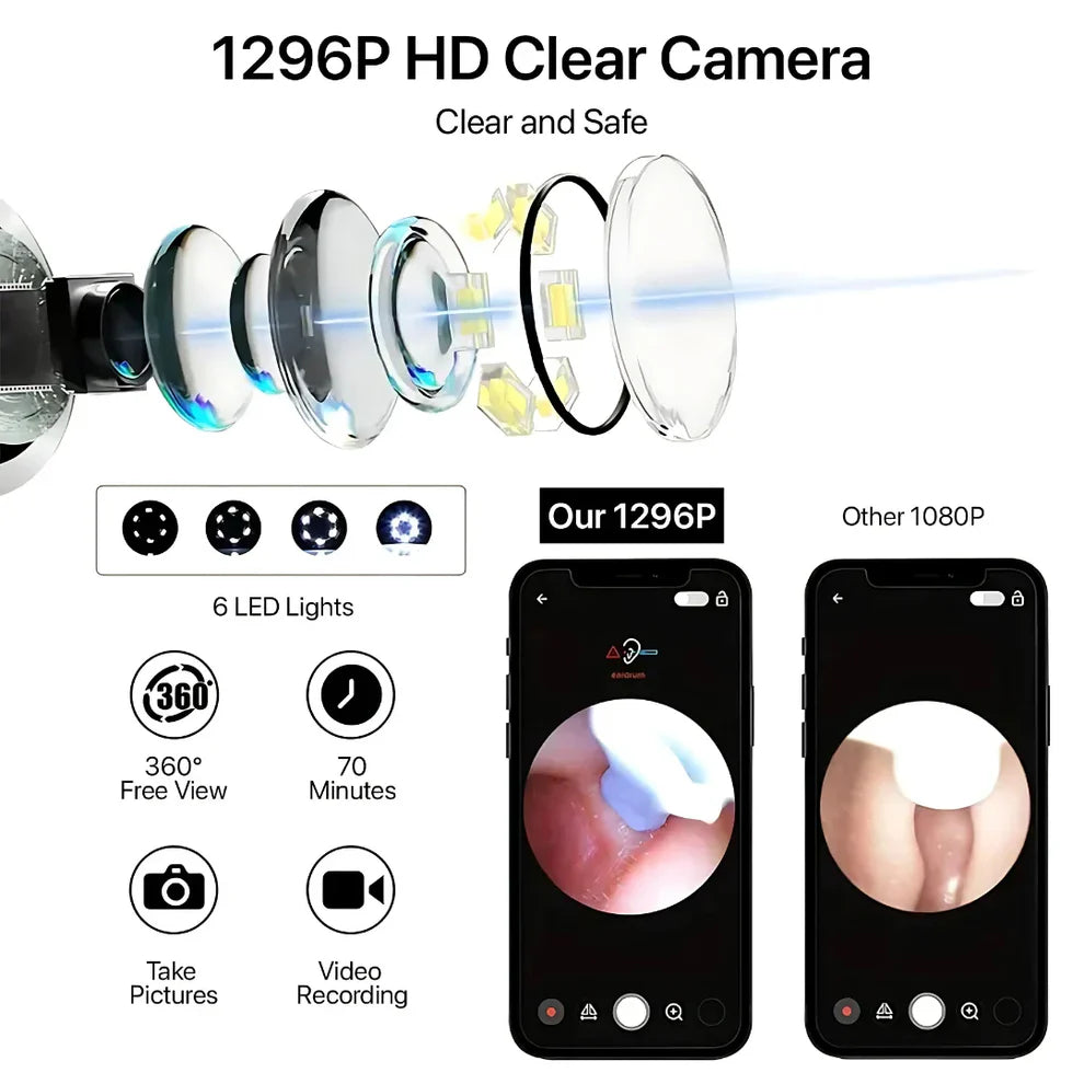 Mart and More Smart Ear Wax Cleaner with 1296P HD Camera & LED Light