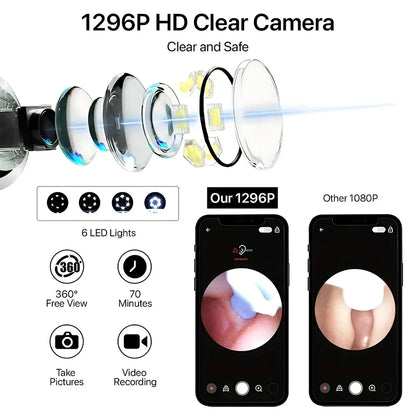 Mart and More Smart Ear Wax Cleaner with 1296P HD Camera & LED Light