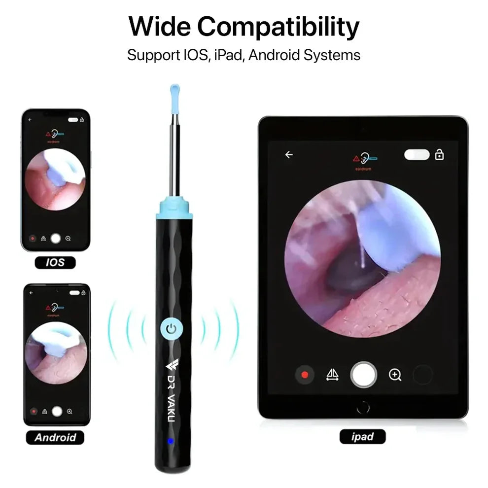 Mart and More Smart Ear Wax Cleaner with 1296P HD Camera & LED Light