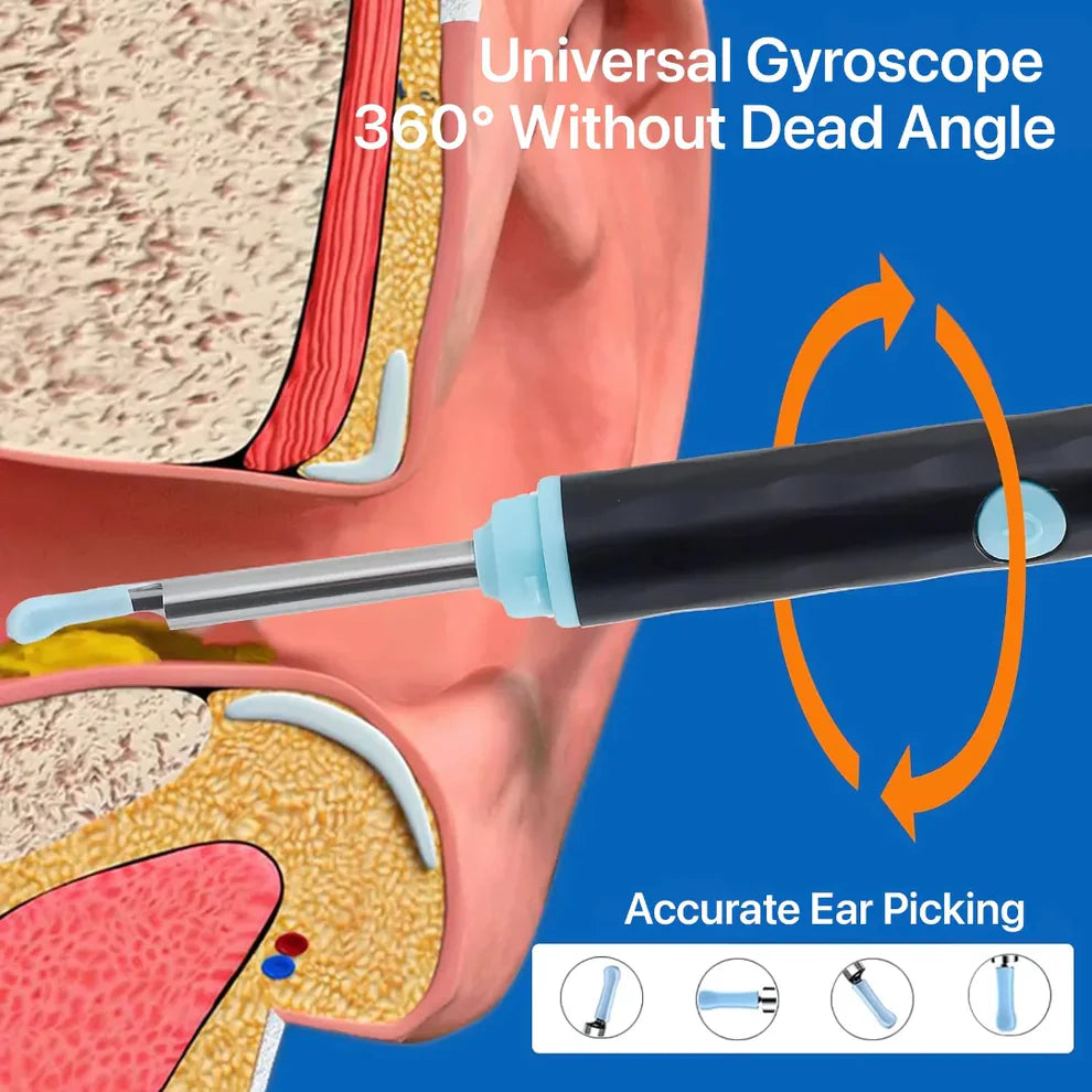 Mart and More Smart Ear Wax Cleaner with 1296P HD Camera & LED Light