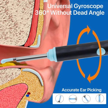 Mart and More Smart Ear Wax Cleaner with 1296P HD Camera & LED Light