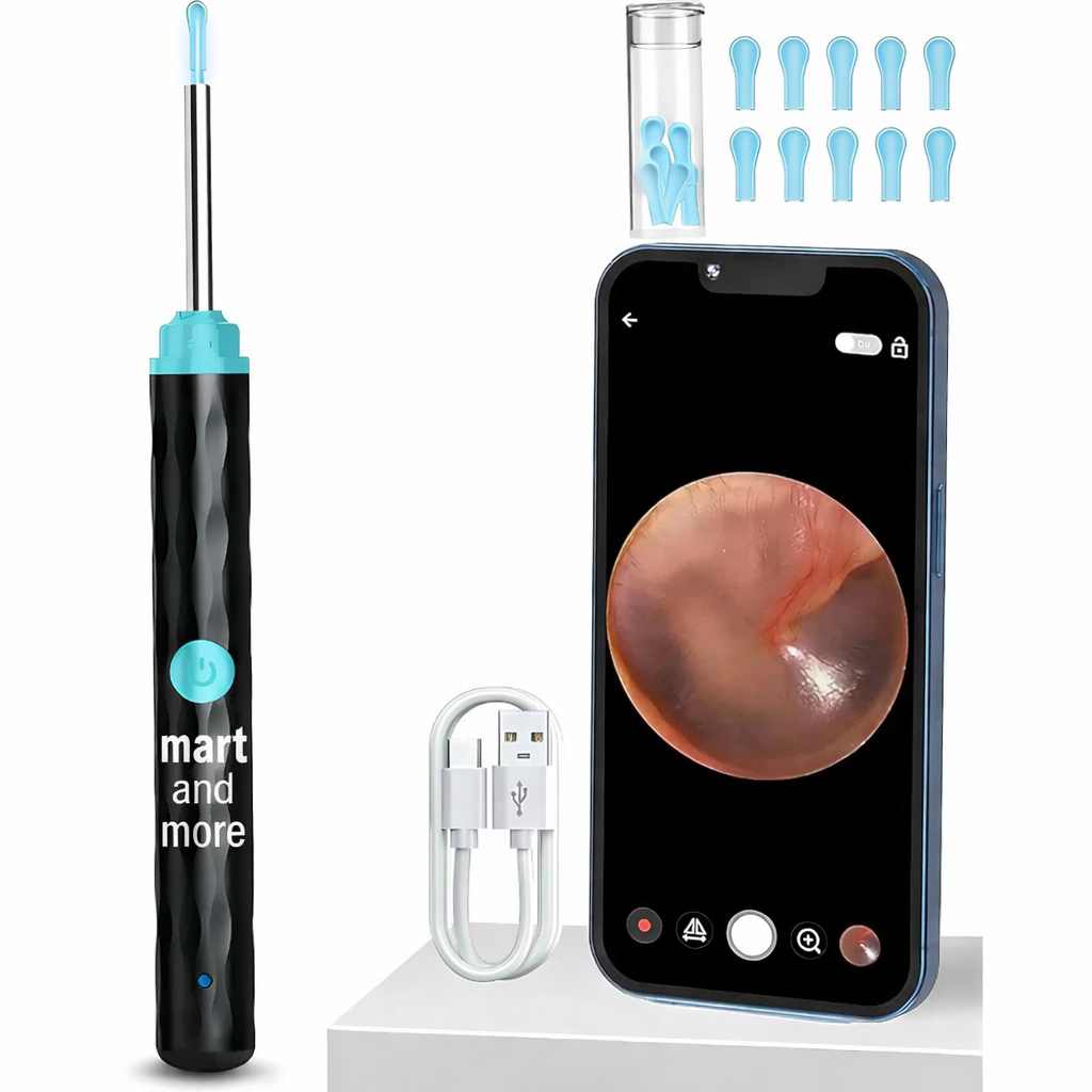 Mart and More Smart Ear Wax Cleaner with 1296P HD Camera & LED Light